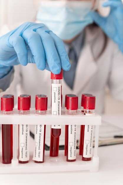 Как правильно подготовиться к анализу крови на ХГЧ?