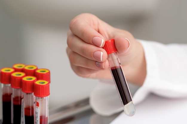 Как проводится анализ ферритина в крови