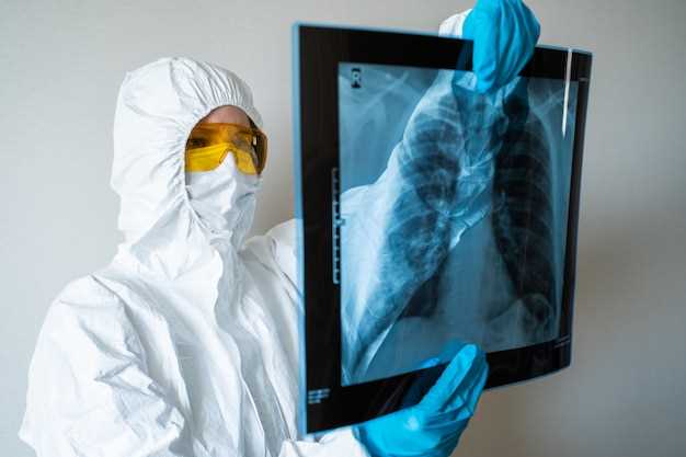 Что определяет заразность туберкулеза