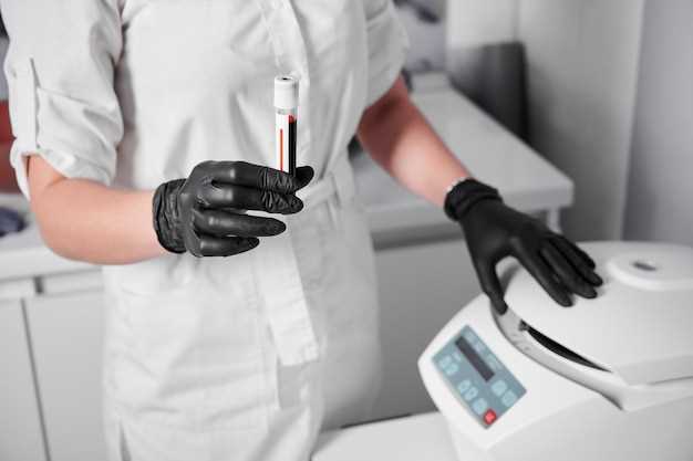 Клинический анализ крови: основные показатели