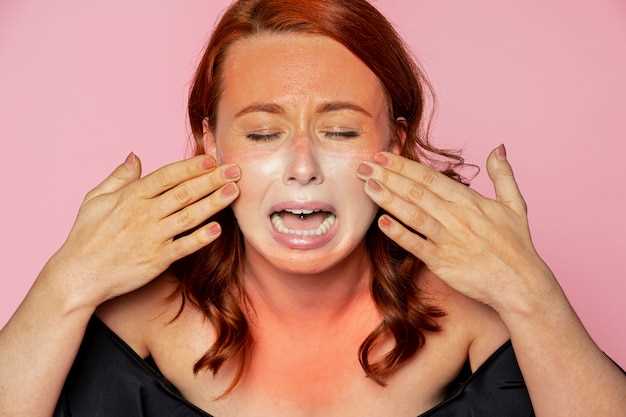 Отеки на лице: причины и симптомы