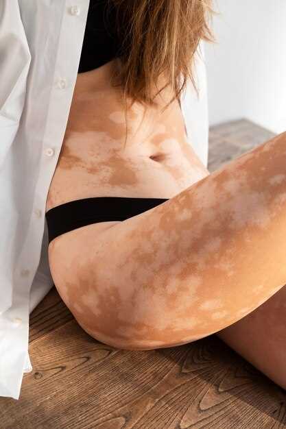 Причины формирования кератом на коже