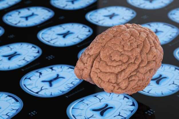Факторы, влияющие на продолжительность жизни при отмирании коры головного мозга