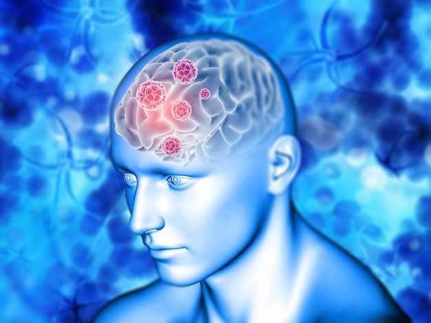 Какие симптомы свидетельствуют о раке головного мозга?