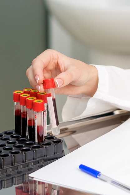 Основные показатели РФМК анализа крови и их значение