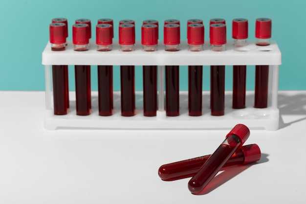РФМК анализ крови: что это и как проводится
