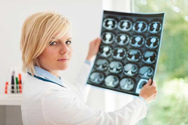 Сколько живут пациенты с диагнозом рак мозга?